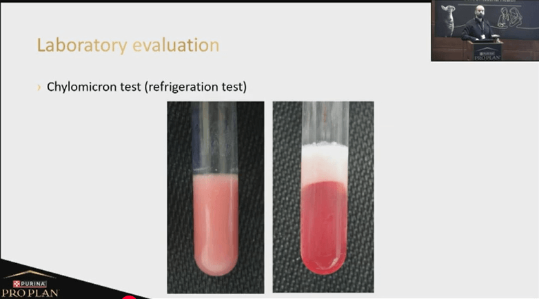 Tackling Complex Hyperlipidemia Cases